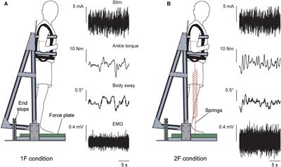 The Vestibular Drive for Balance Control Is Dependent on Multiple <mark class="highlighted">Sensory Cues</mark> of Gravity